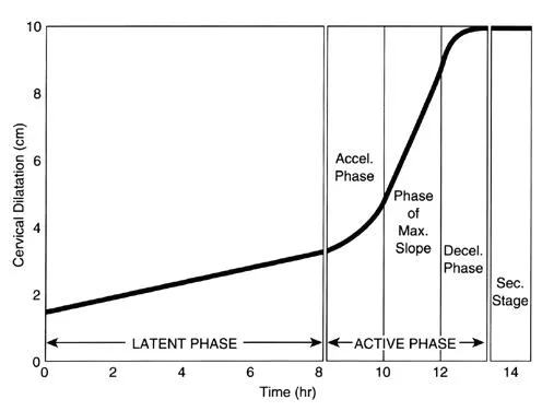 Labor curve: Latent and active phases of cervical dilation