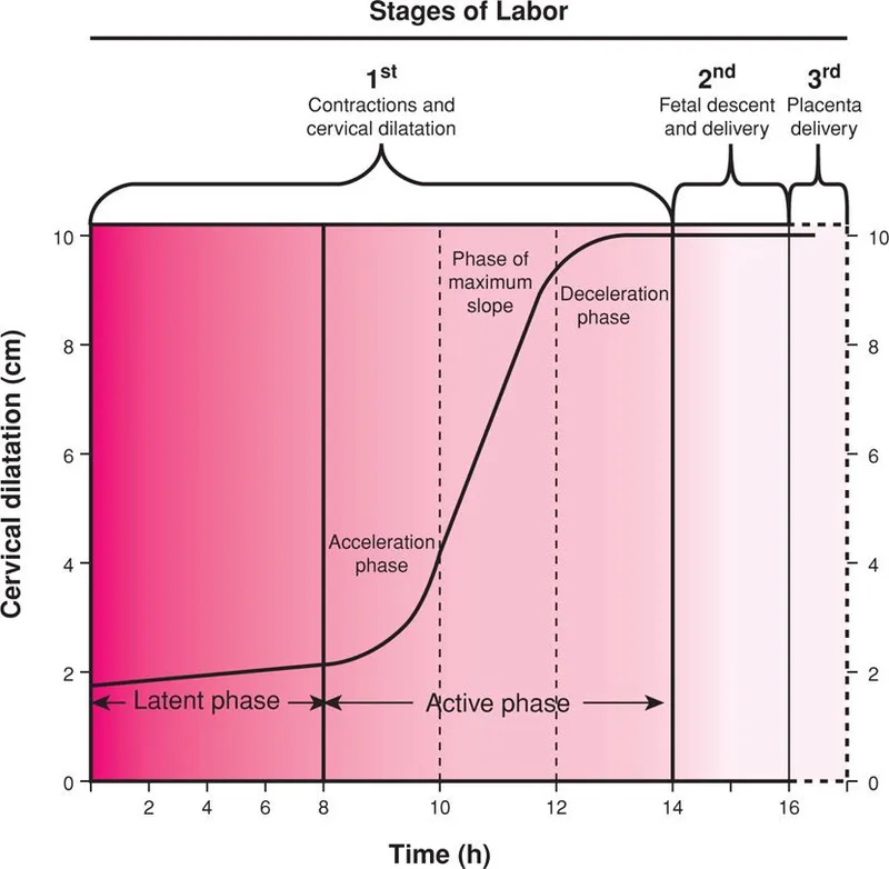 Friedman Labor Curve: Cervical Dilation vs. Time