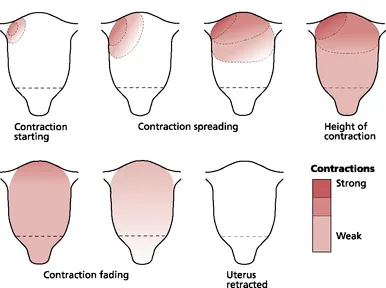 Physiology of uterine contractions showing fundal dominance