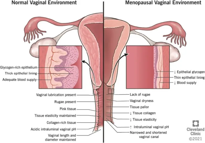 Normal vs. Menopausal Vaginal Environment
