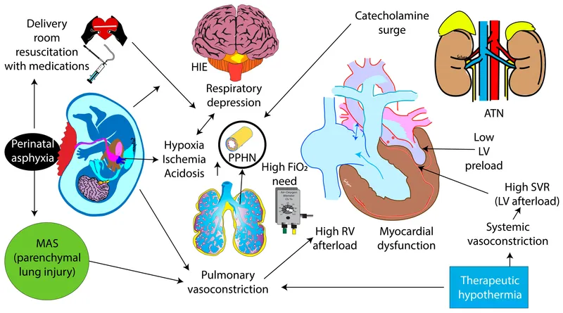 Pathophysiology of Perinatal Asphyxia and HIE