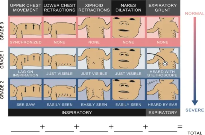 Silverman-Andersen Score for Neonatal Respiratory Distress