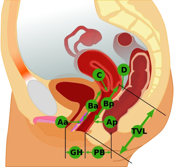 POP-Q Measurement Points