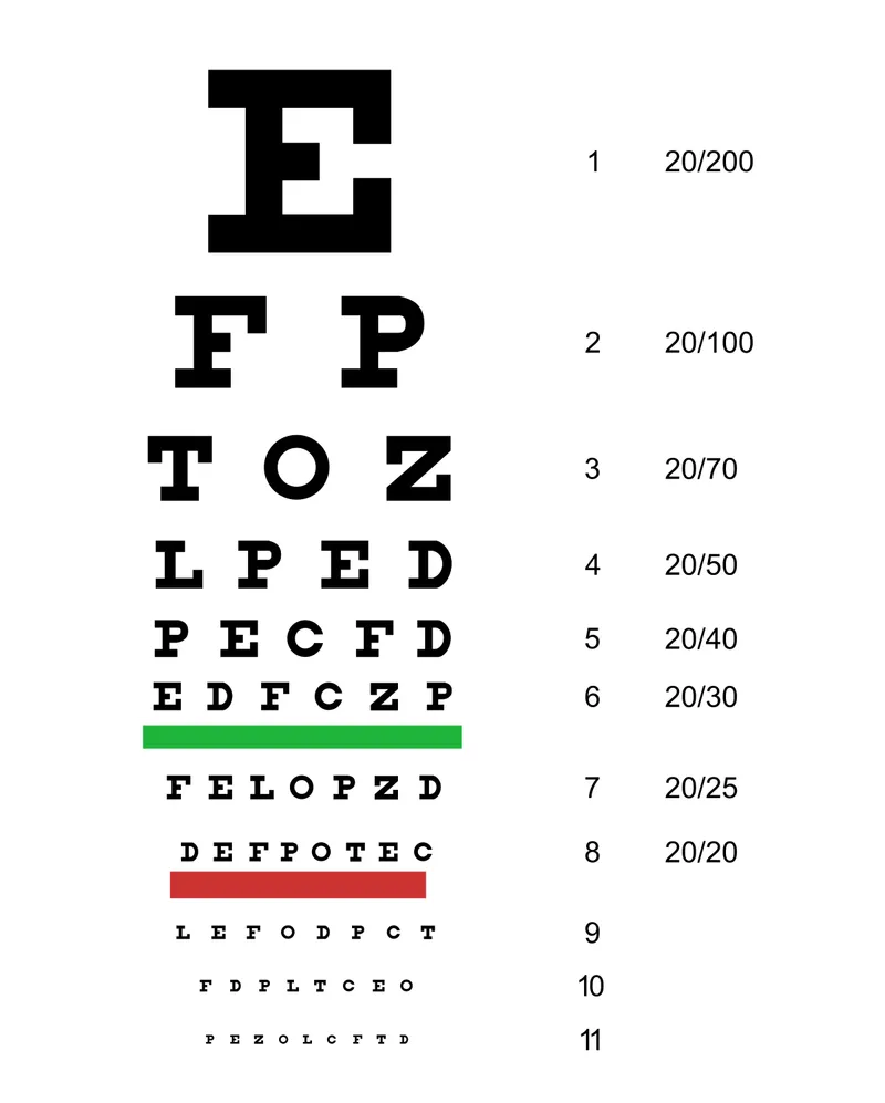 Snellen eye chart for vision screening