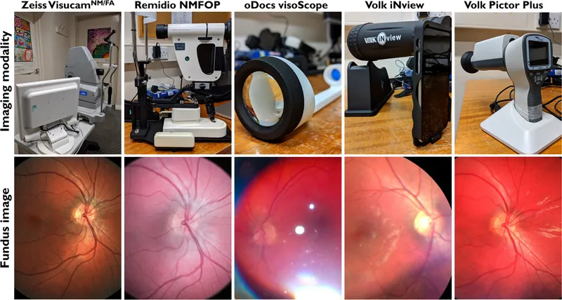 Fundus cameras for telemedicine