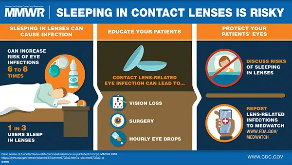 Risks of sleeping in contact lenses