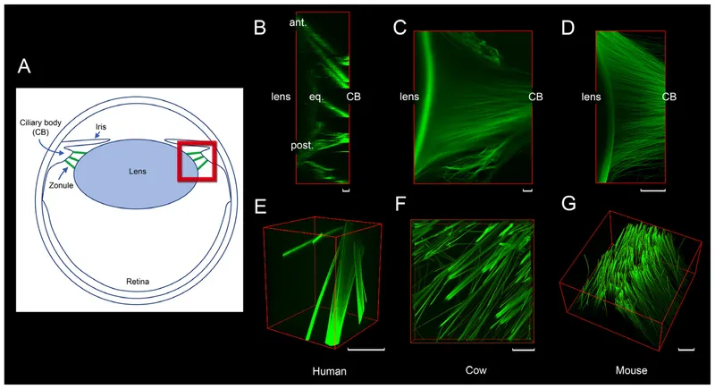 Zonular anatomy and structure