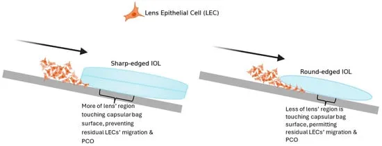 Sharp vs Round IOL Edge Effect on PCO