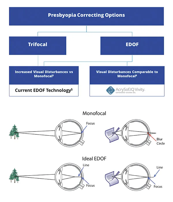 Monofocal vs Ideal EDOF IOL Light Focus