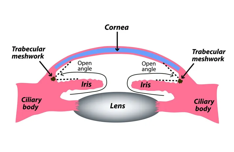 Eye anatomy diagram showing trabecular meshwork