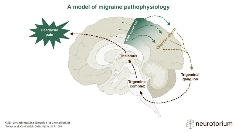 Migraine Pathophysiology: Cortical Spreading Depression