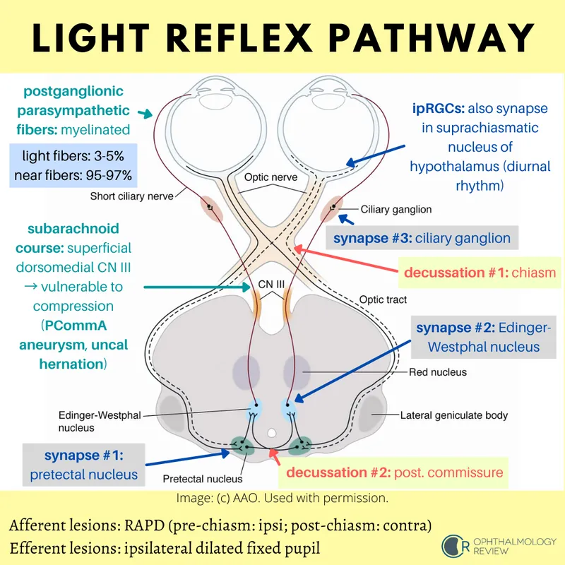 Pupillary Light Reflex Pathway Diagram