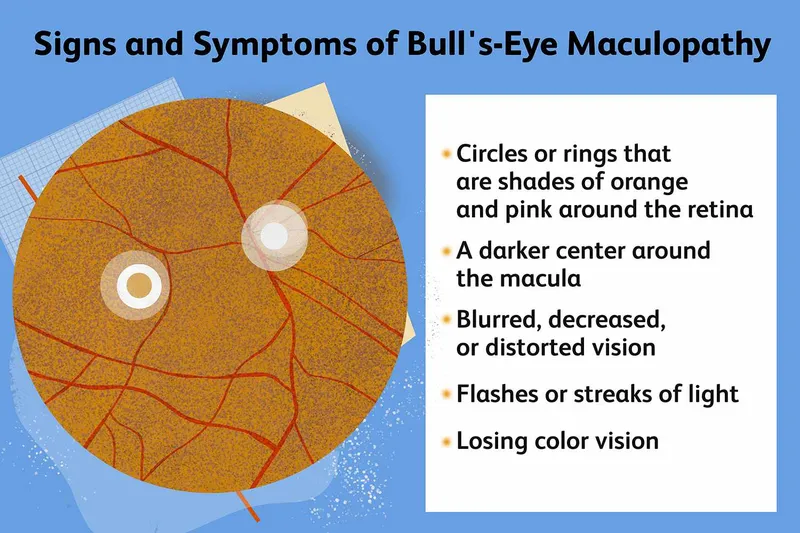 Signs and Symptoms of Bull's-Eye Maculopathy