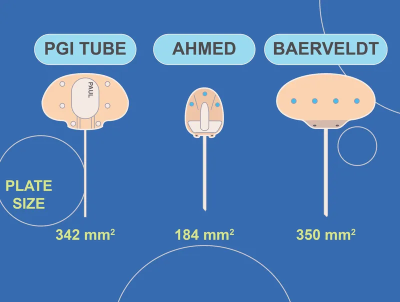 Plate size comparison of PGI, Ahmed, and Baerveldt