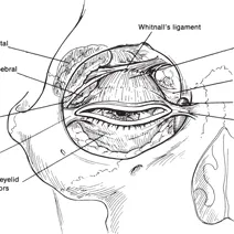 Eyelid Anatomy for Oculoplastic Surgery
