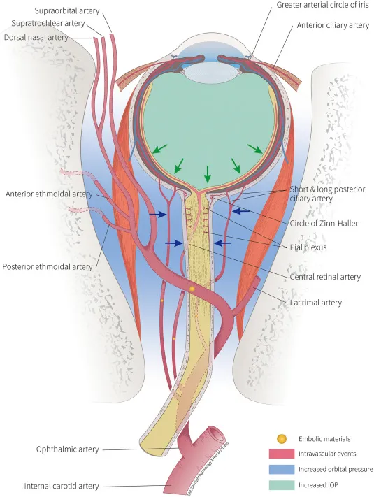 Ocular Neurovascular Supply and Embolic Events
