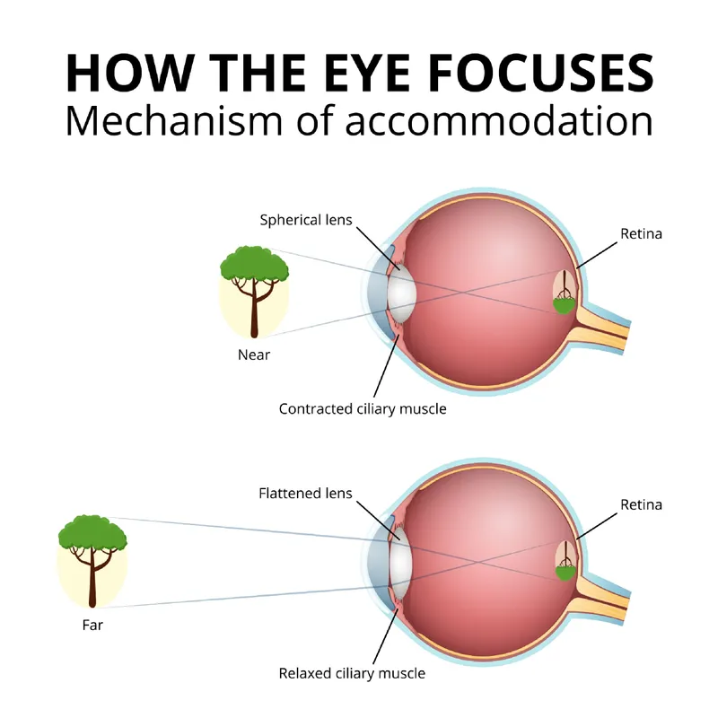 Eye accommodation mechanism: near vs far focus