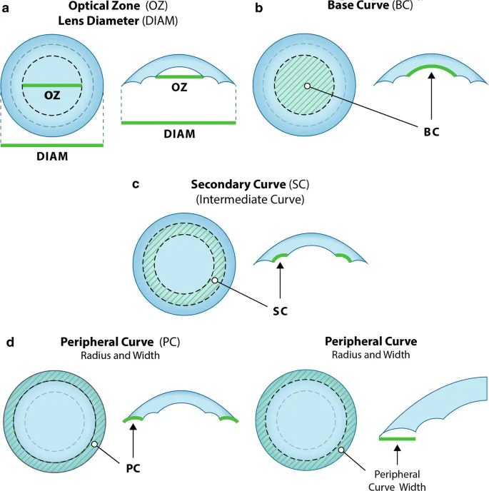 Contact Lens Parameters Diagram