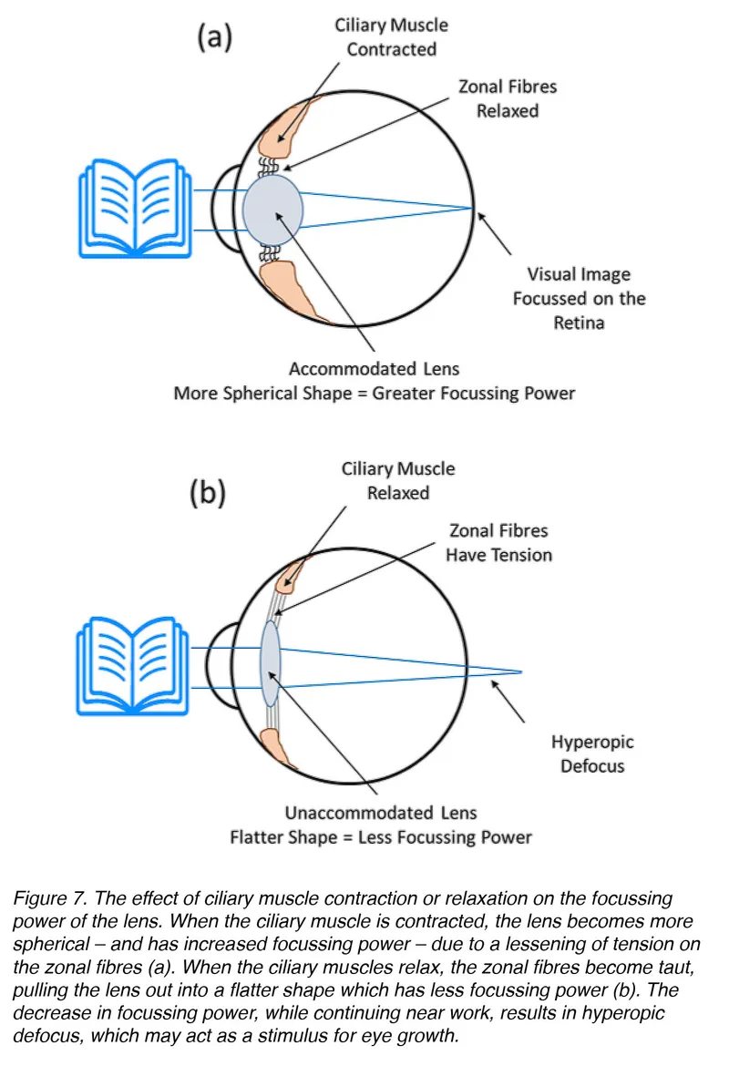 Accommodation: Ciliary muscle, zonal fibres, lens shape