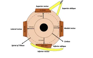Extraocular muscle insertions and distances from limbus