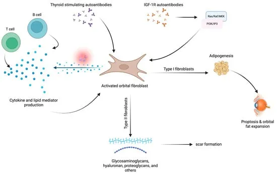 Pathogenesis of Thyroid Eye Disease