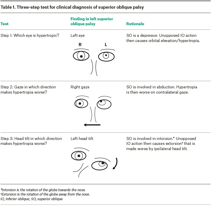 Parks-Bielschowsky 3-step test