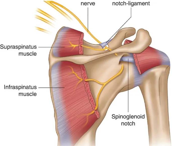 Suprascapular nerve at risk during shoulder arthroscopy