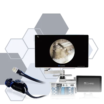 Arthroscopic tower setup with scope, camera, and monitor