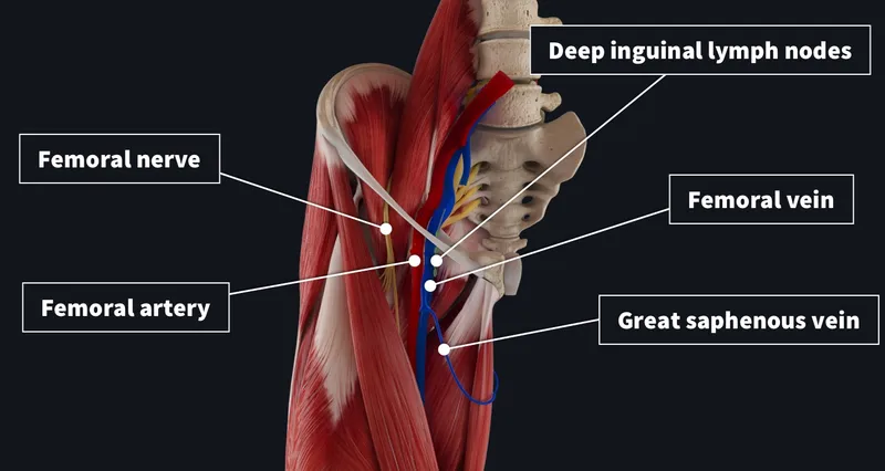 Femoral triangle anatomy with NAVEL contents