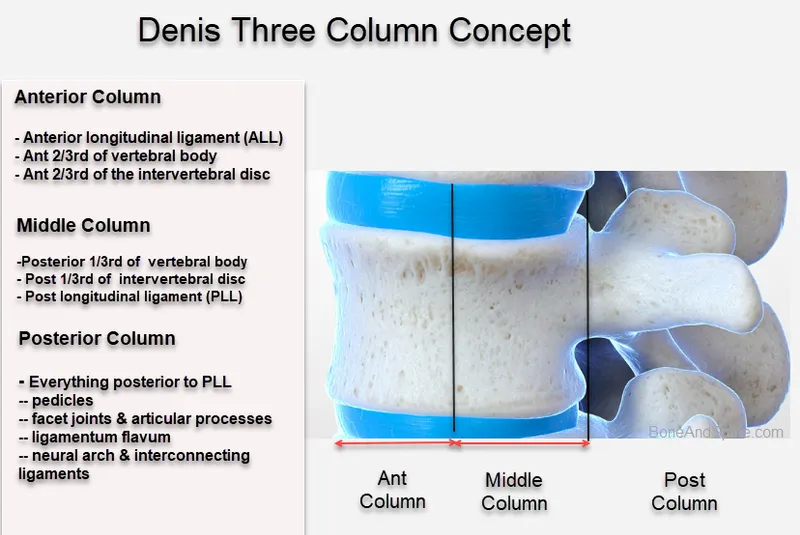 Denis Three Column Concept of Spinal Stability