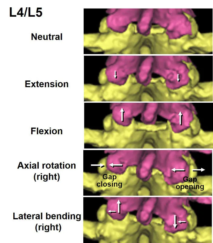 L4/L5 facet joint movement in different spinal motions