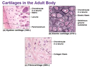 Three types of cartilage
