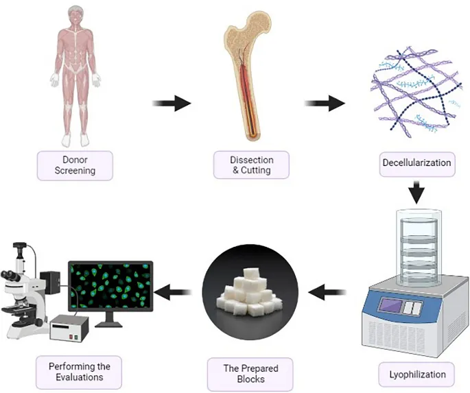 Allograft Bone Processing Steps