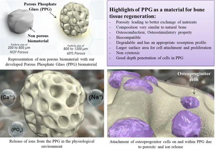 Porous Phosphate Glass (PPG) biomaterial for bone grafts