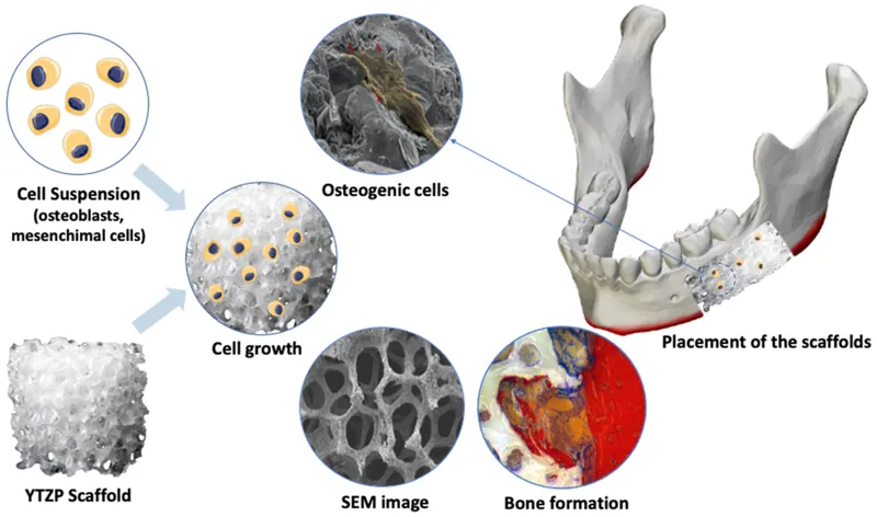 Bone graft scaffold and cell growth process