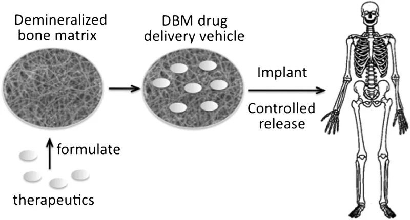 DBM as a drug delivery vehicle for bone regeneration