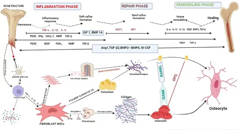 Bone Healing Phases and Growth Factor Involvement