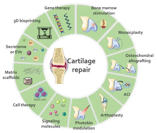 Cartilage repair techniques