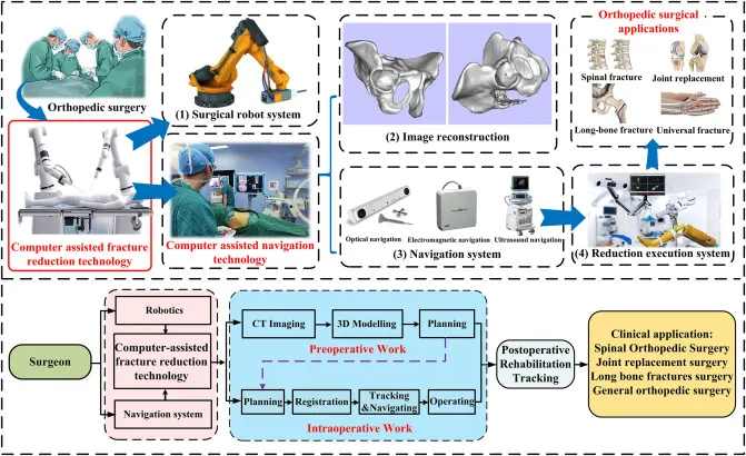 Computer-assisted orthopedic surgery workflow