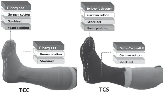 TCC and TCS Cast Layers for Diabetic Foot Ulcers