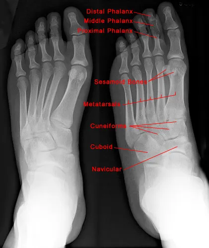 Foot bones anatomy X-ray with labels