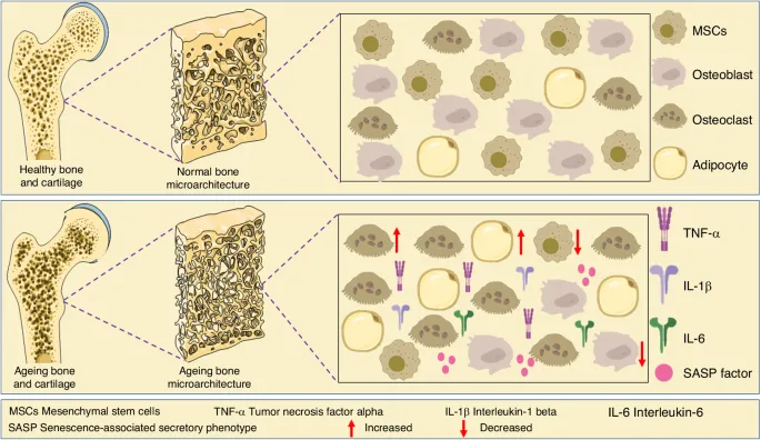 Healthy vs. Ageing Bone Microarchitecture & Cells