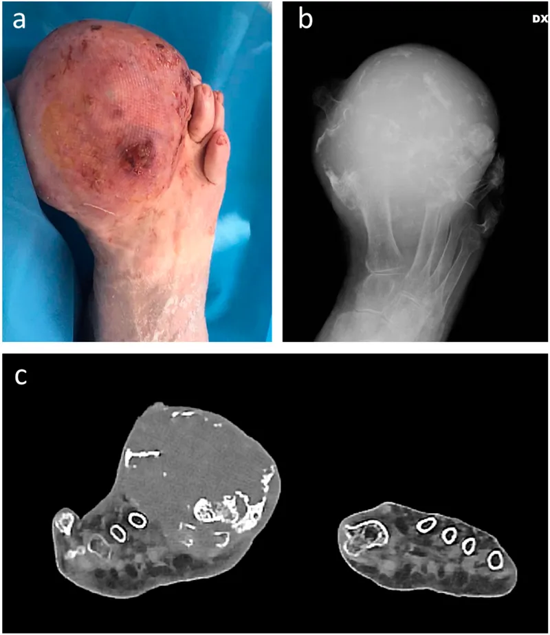 Soft tissue sarcoma clinical presentation and imaging