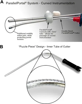ParallelPortal System Curved Instrumentation