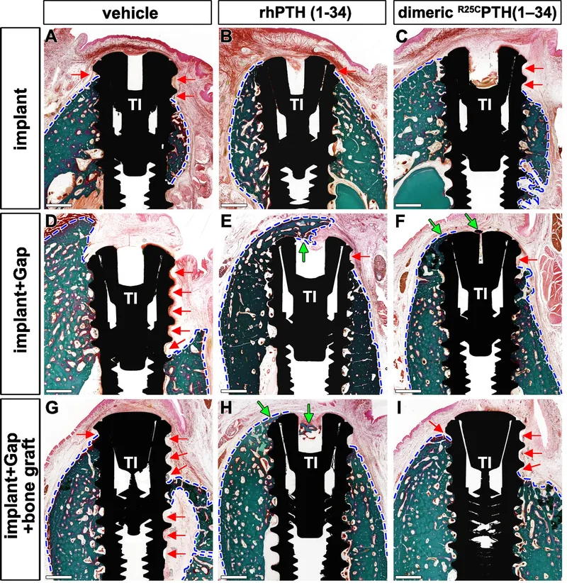 Histology of bone healing around implants
