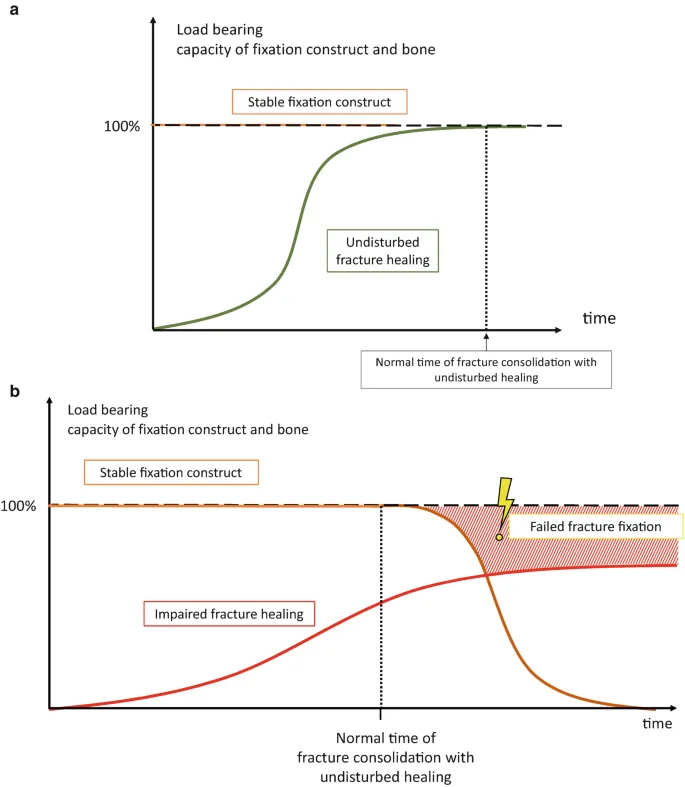 Fracture healing with stable vs failed fixation