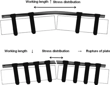 Working length and stress distribution in orthopedic plates