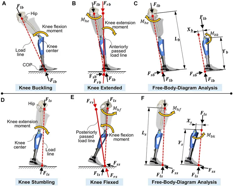 Biomechanics of prosthetic knee and ankle during gait