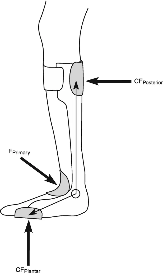 3-point pressure system in lower limb orthosis