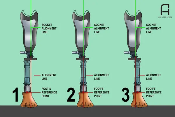 Prosthetic alignment lines and reference points